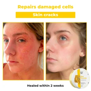 vDobshow™ Bee Venom Therapy Cream